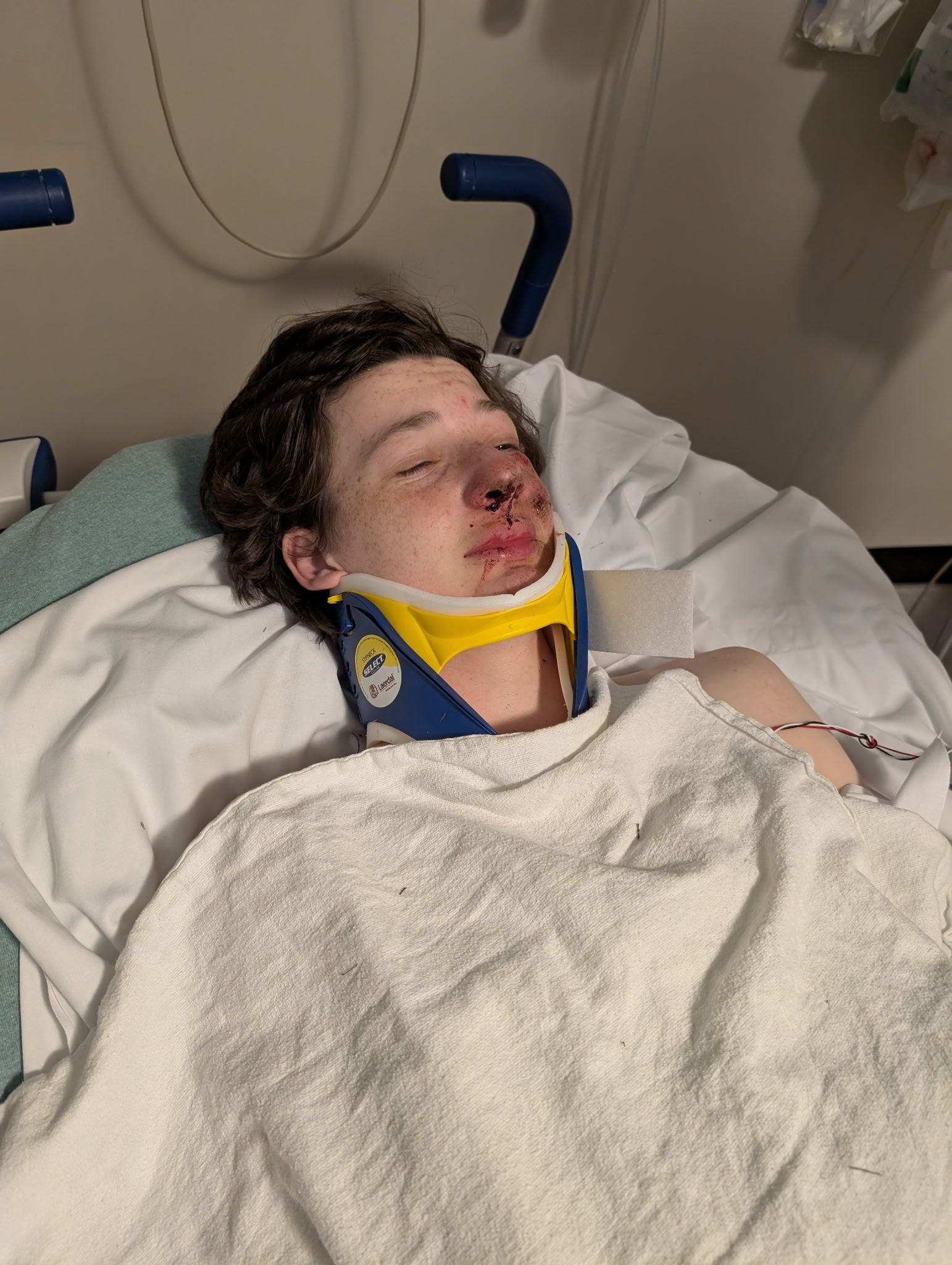 Axel Henderson laying in a hospital bed with a neck brace and with visible injuries to his face