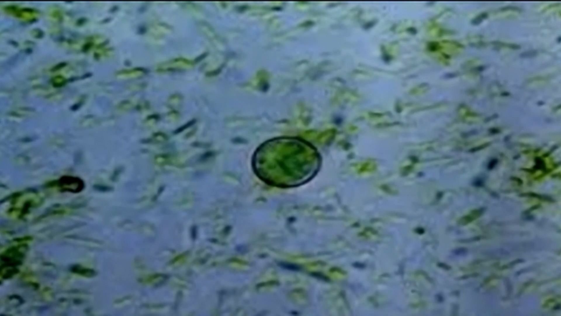 Explosive diarrhea? Here's what to know about Cyclospora