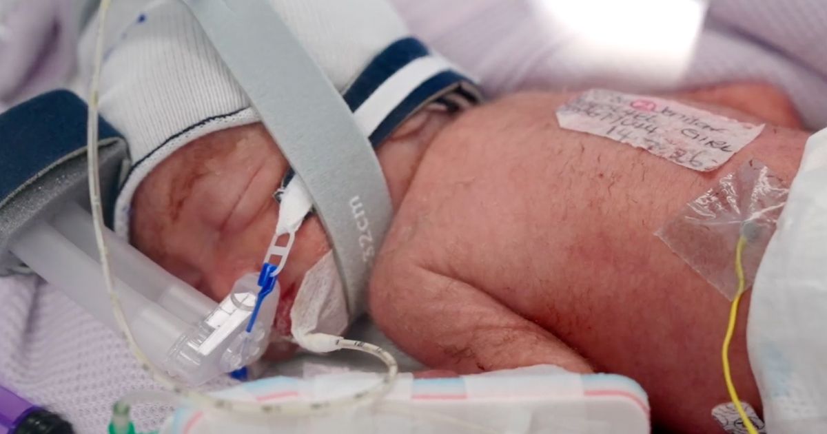 After an extremely rare pregnancy, an Australian woman gives birth to identical quadruplet girls
