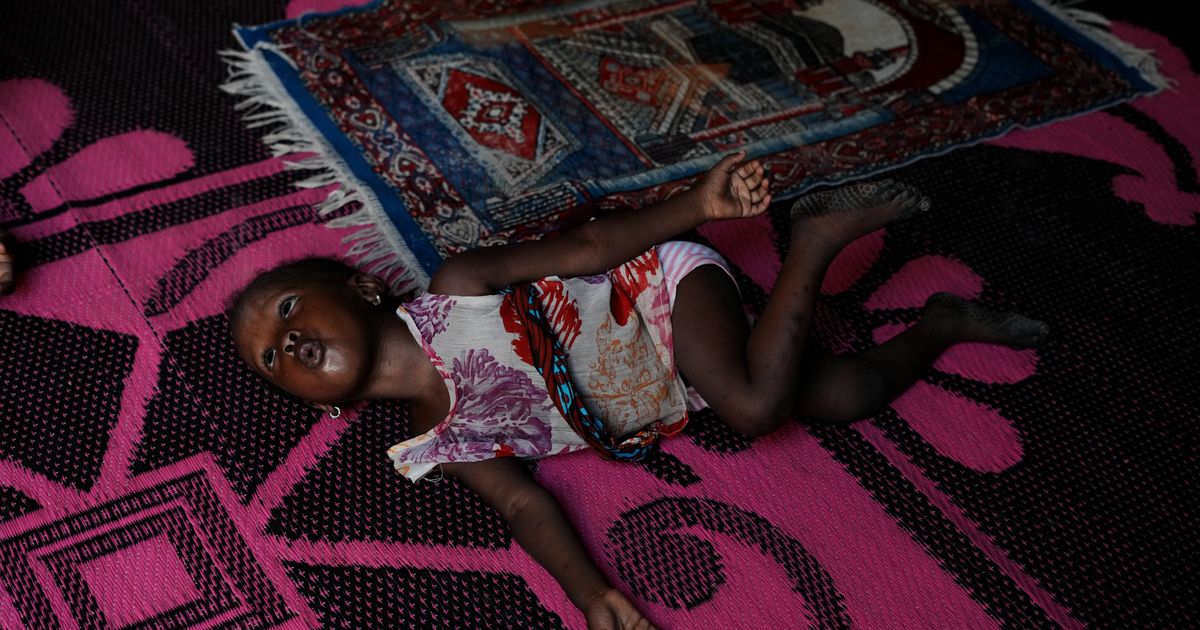Nigerian children pay the price for the Iran war as malnutrition and poverty surge