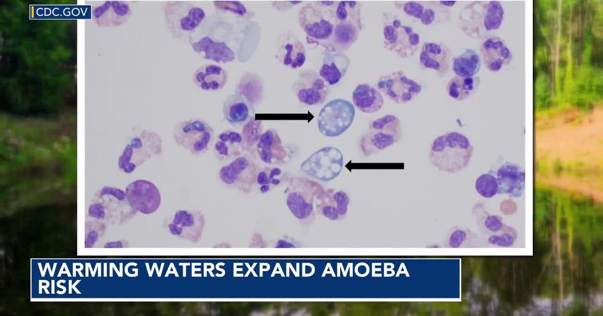 Warming waters could expand brain-eating amoeba risk - WRAL