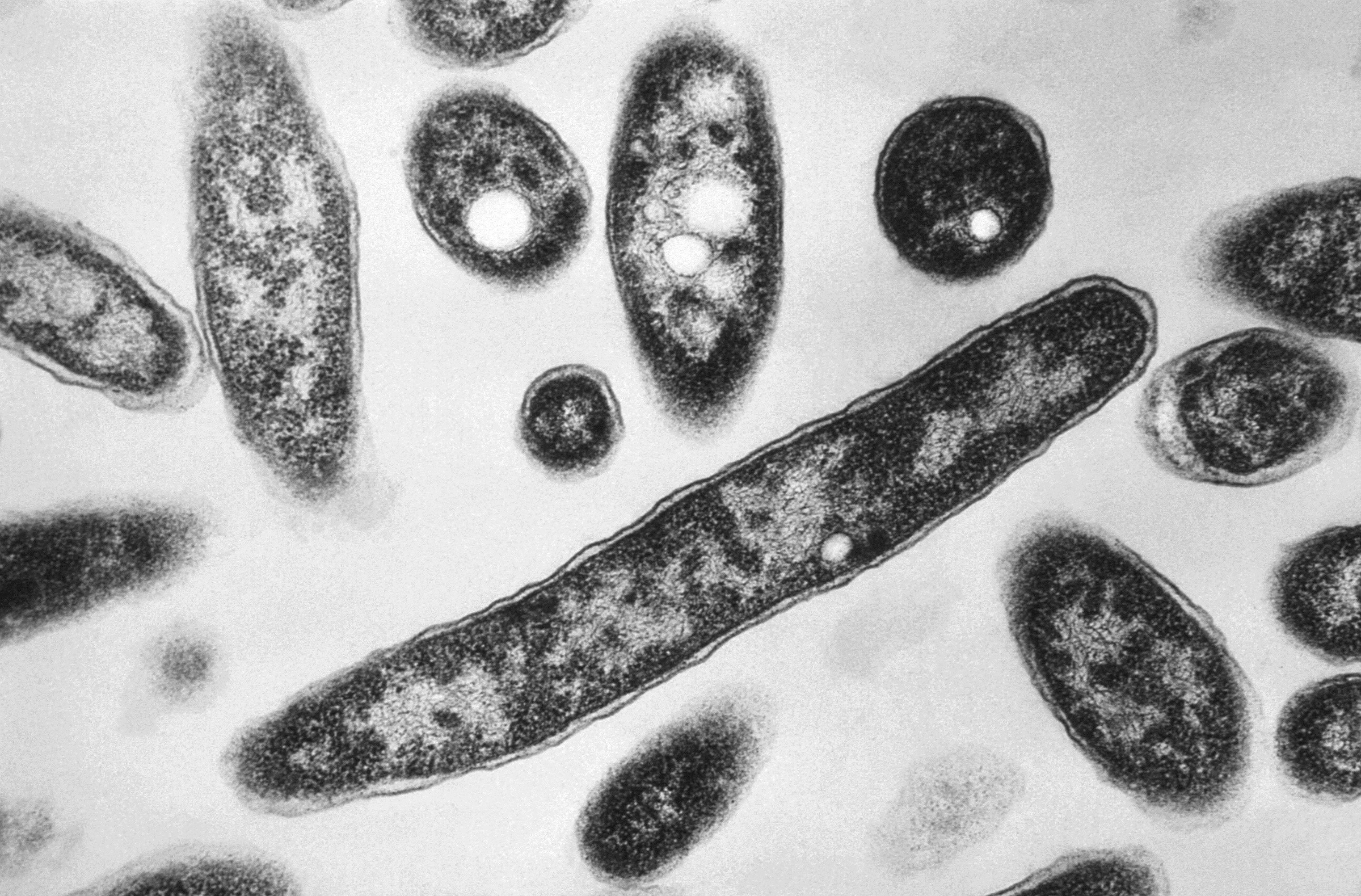 Second death reported in Legionnaire disease outbreak in New York City :: WRAL . com