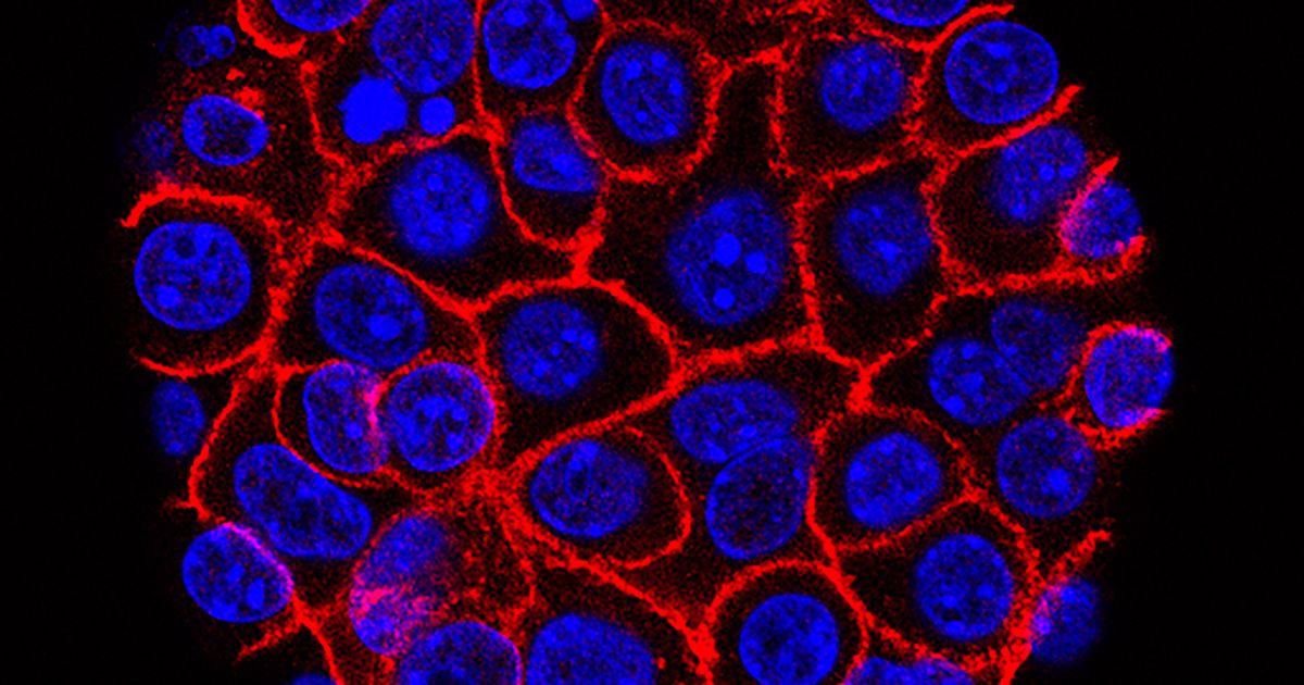 Experimental pill promises new hope for deadly pancreatic cancer