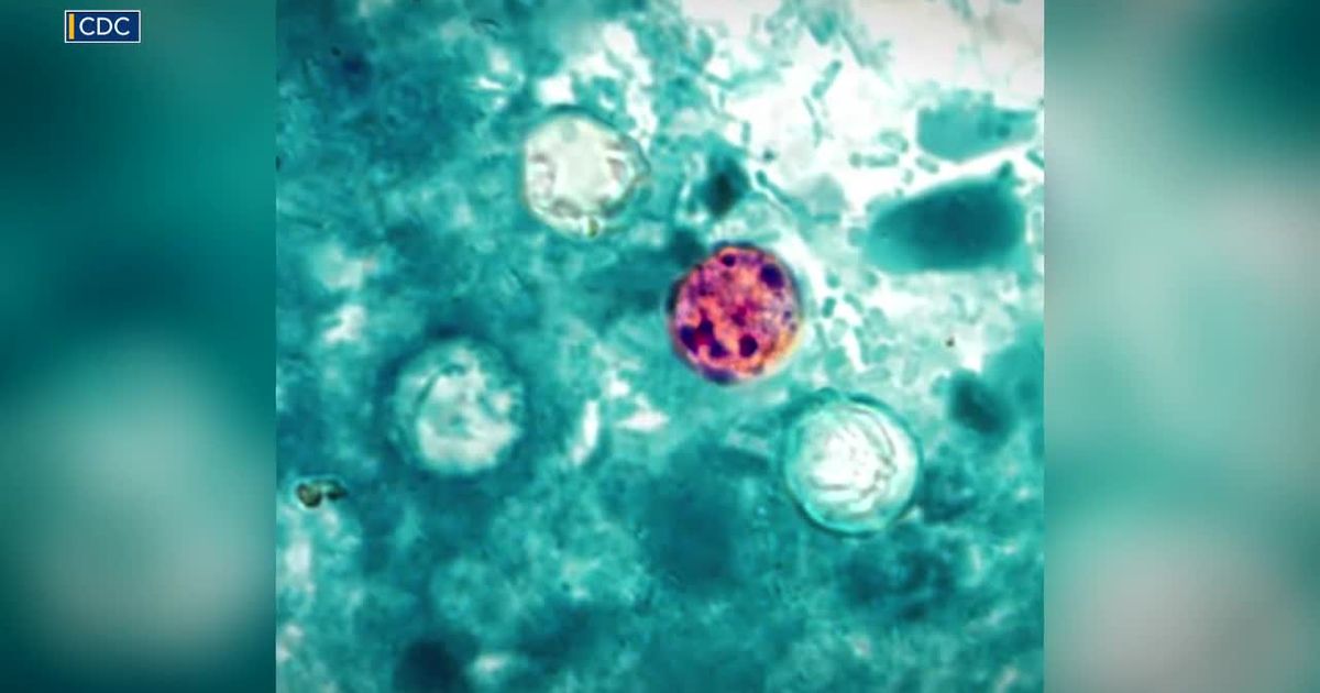 Explosive diarrhea? Symptoms, prevention and other answers about stomach bug cyclospora