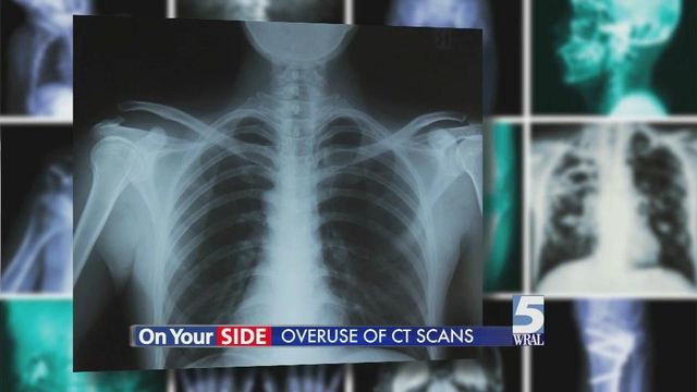Consumer Reports: The dangers of CT scans