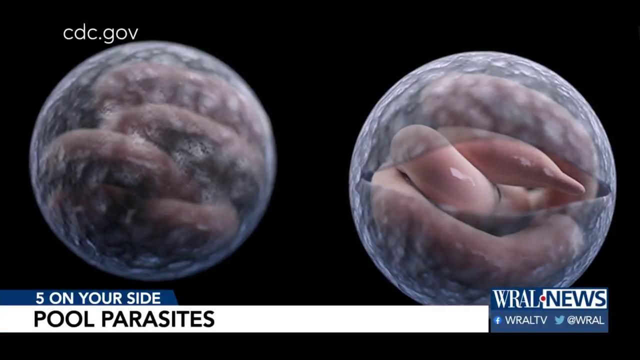 Pool parasites: How to avoid them this summer