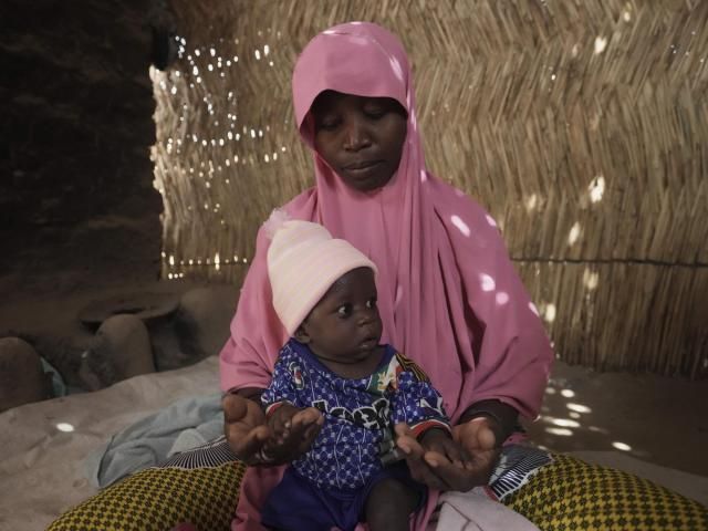Malnutrition Crisis Deepens in Northeastern Nigeria Amid Funding Cuts