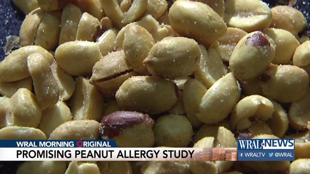 Triangle-based peanut allergy study 'promising'