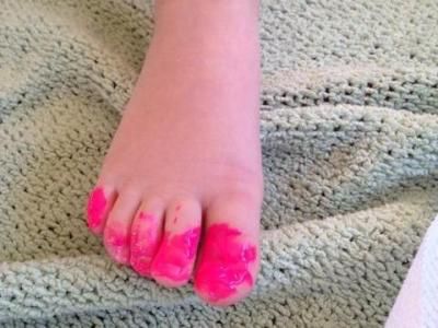 Pink toes