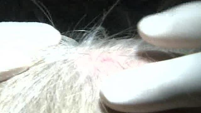 Women Have Options to Deal With Hair Loss