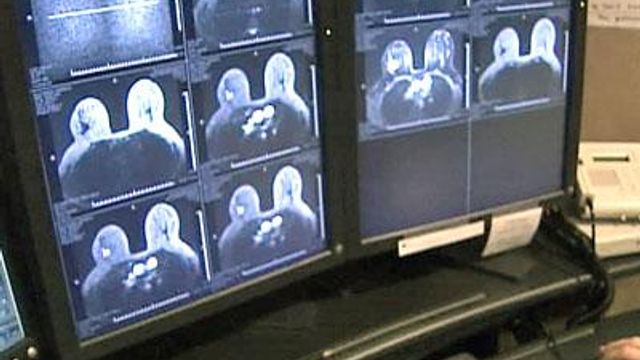 3-D Imaging Can Make Breast Cancer Treatment More Effective