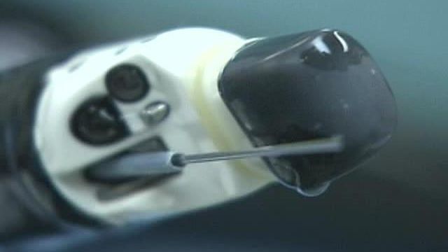 New Technique Seen as Alternative to Exploratory Surgery