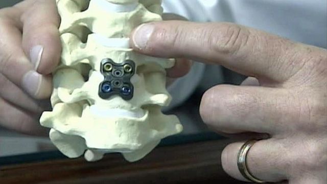 Artificial Disk Can Take Away Neck Pain, Restore Motion