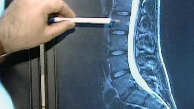 Fees for Neck, Back Treatment Go Up But Patients Aren't Getting Better