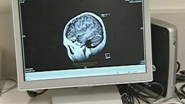 Brain tumor genetics study offers insight