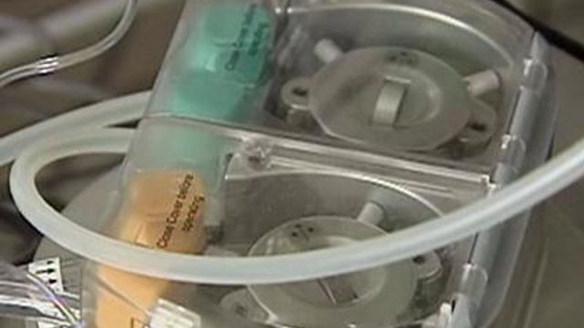 'Liver machine' can help transplant patients in need