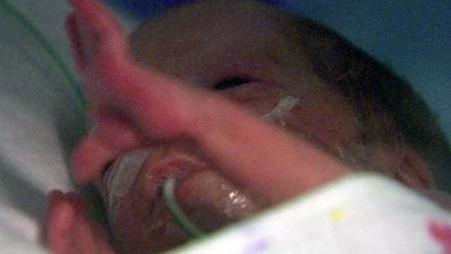 Device checks infant's eyes