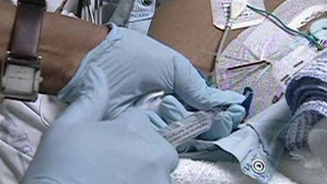 MRSA infections at hospitals rates drop