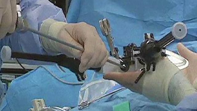 ‘SPIDER’ allows for less-invasive surgeries