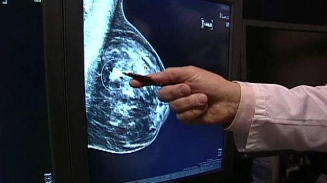 Breast cancer patients can opt for less-invasive surgery