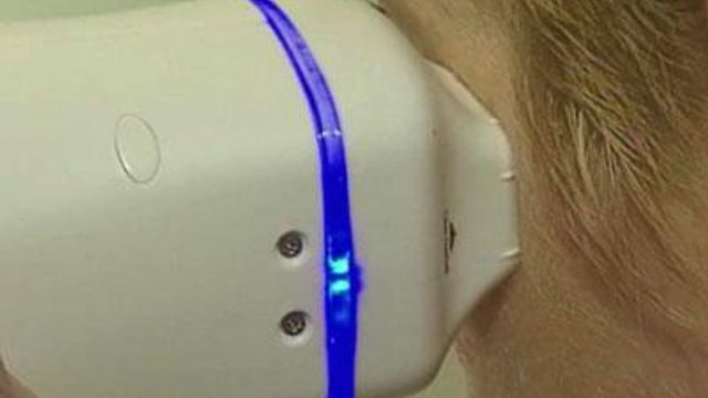 Laser skin treatment comes home 
