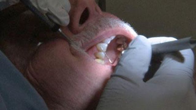 Oral hygiene impacts gums