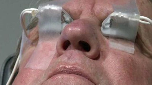 New device offers relief to those with dry eyes