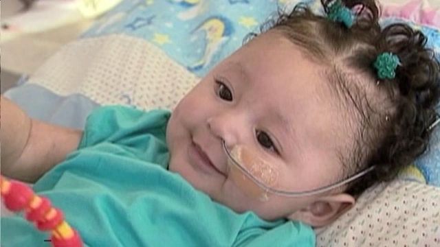 Tiny heart pump helps babies, children stay alive