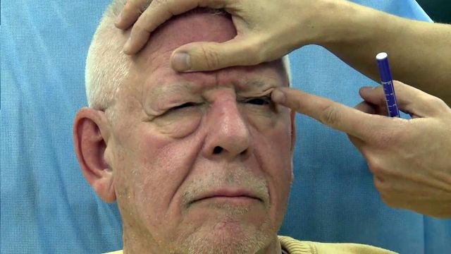 Eye lifts can help men with vision problems