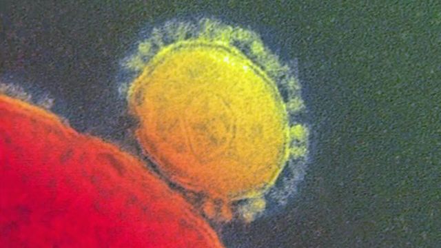 NC doctors looking out for MERS symptoms