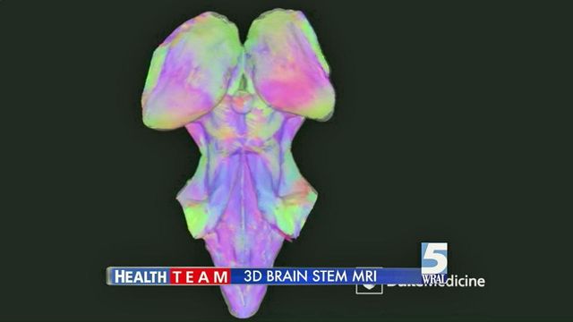 Detailed look at brain stem could yield treatment breakthroughs