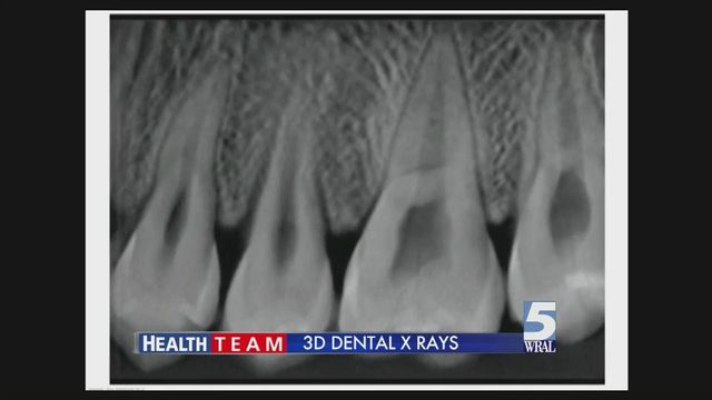 UNC researchers develop new technology for dental X-rays