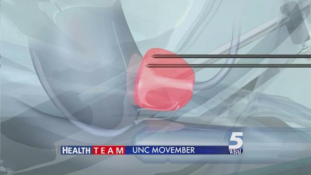 Early detection is key to fighting prostate cancer