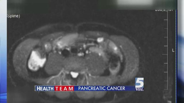 Fighting pancreatic difficult but possible