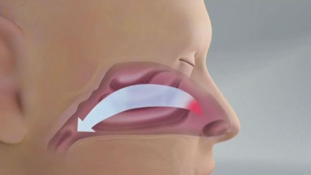 New 5-minute procedure helping those with nasal passage issues breathe easier