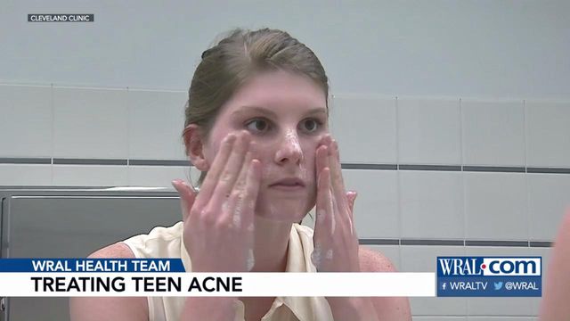 Persistence is key to treating acne symptoms in teens