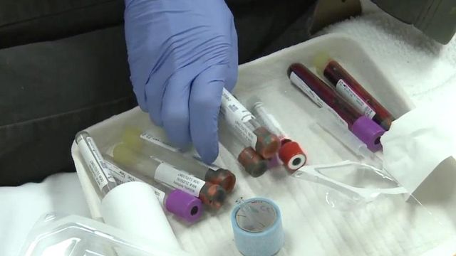 UNC study aims to find HIV prevention drug