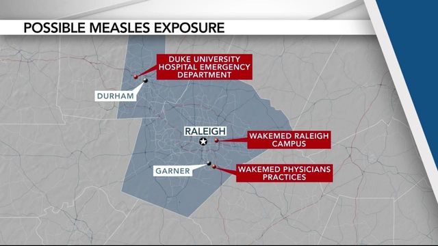 Mask: ‘We just don’t see a lot of measles’ 
