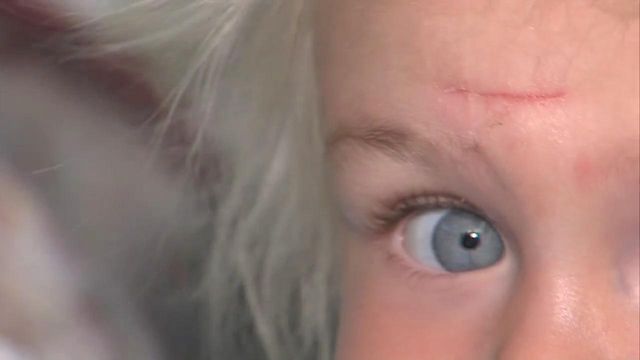 How to Know if My Child Needs Stitches - Elite Hospital Kingwood