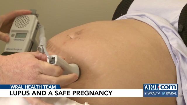 Safe pregnancy possible for moms with lupus