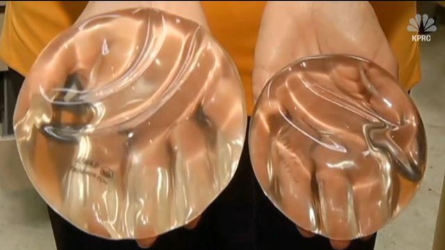Doctors issue warning about breast implants