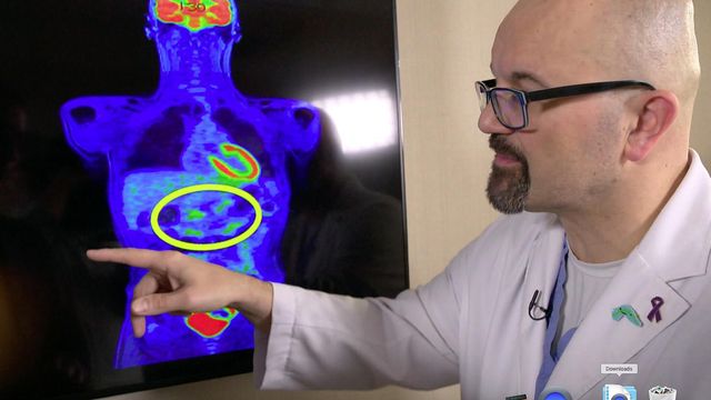 New approach treating pancreatic cancer defies odds