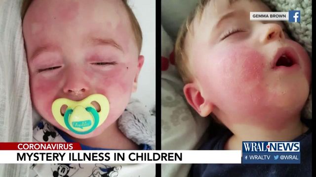 Health experts look into mysterious child illness