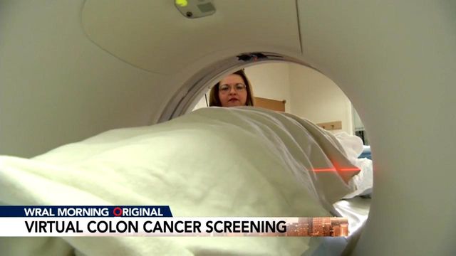 Doctors hope new colon cancer screenings bring attention to disease