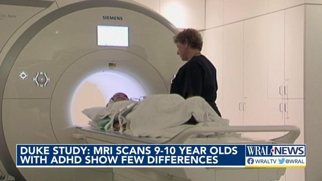 MRI scans show few differences between children with ADHD and those without