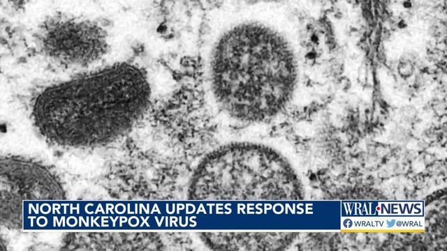 As cases tick upward, NC health leaders update response to monkeypox virus 