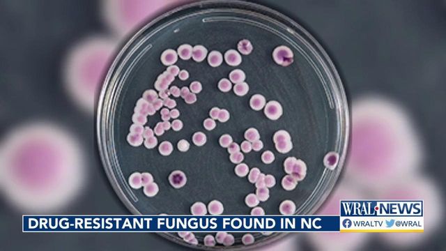 Drug-resistant fungus found in NC