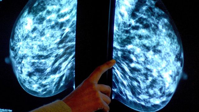 Fingerprint test could replace mammogram