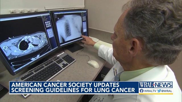 American Cancer Society updates screening guidelines for lung cancer