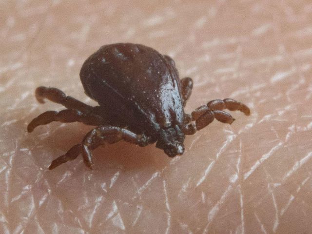 Three Dead In Outbreak Of Rocky Mountain Spotted Fever, CDC Warns